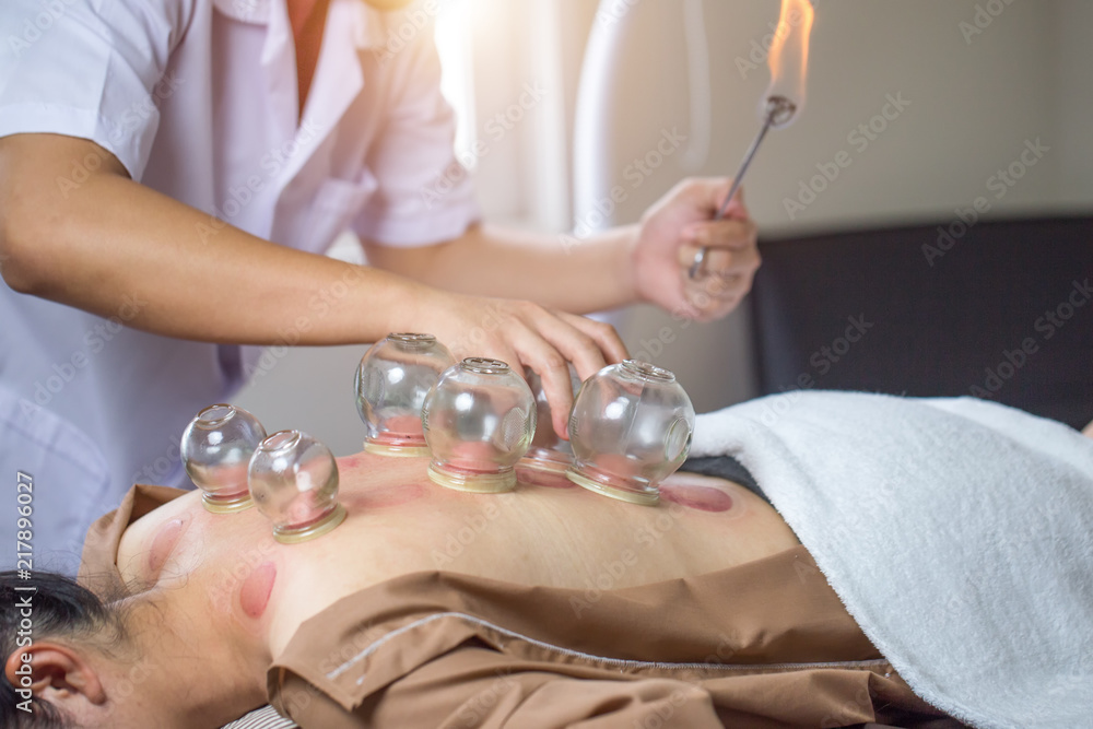 Does acupuncture for fertility treatment work?