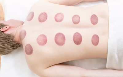 The many benefits of acupuncture in winter